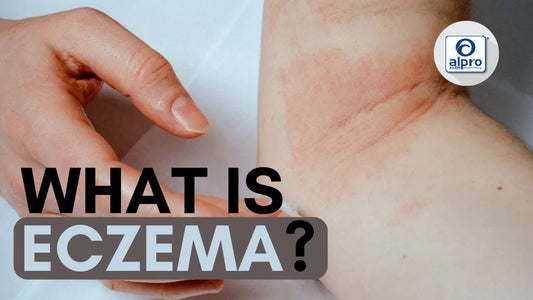 Featured image for What is eczema?