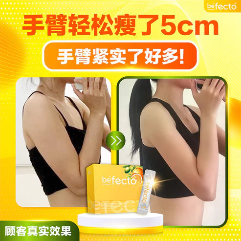 Befecto Slim Body Booster 30s | Support Weight Management (Delivery Start 30/11/2025) Beseen