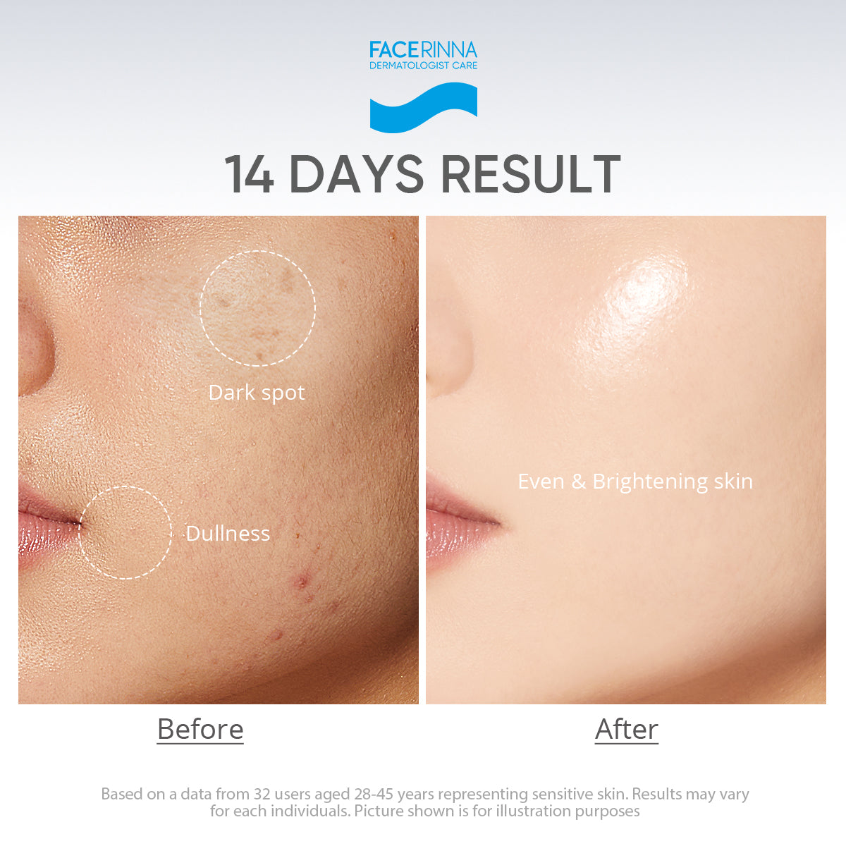 [Group Buy Delivery Starts: 20/7/2026] Facerinna Niacinamide Brightening Serum Sunscreen SPF 50 PA++++ | No White Cast Group Buy
