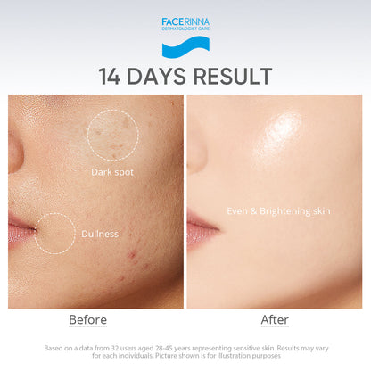 [Group Buy Delivery Starts: 20/7/2026] Facerinna Niacinamide Brightening Serum Sunscreen SPF 50 PA++++ | No White Cast Group Buy