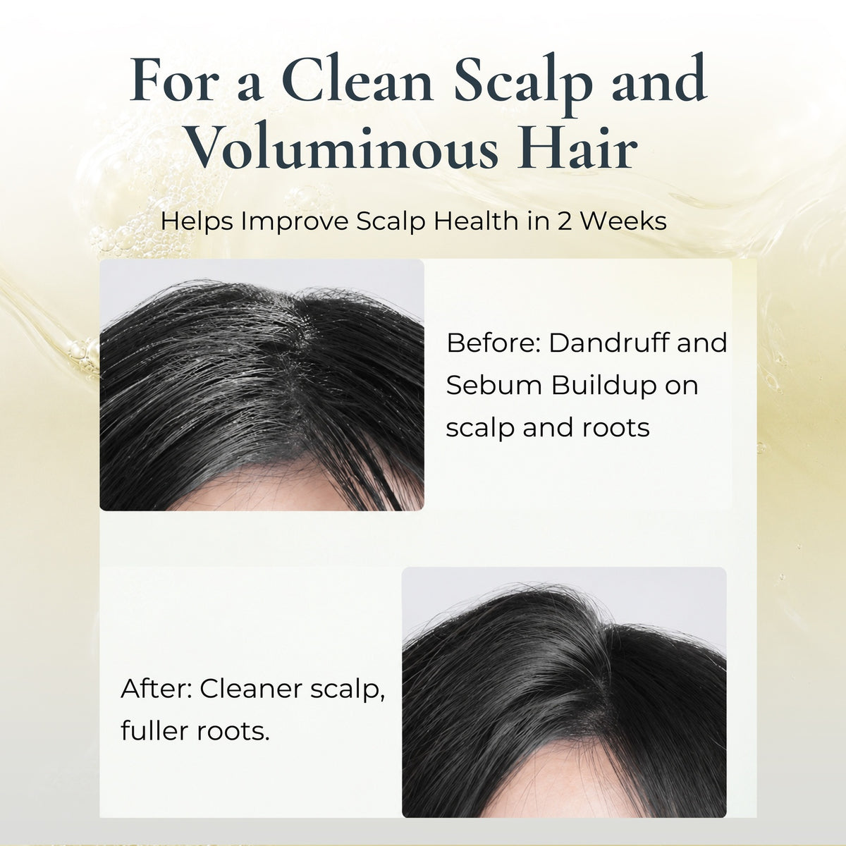 Off & Relax Spa Purifying Scalp Cleanser 150ml | Gently Cleanses and Purifies Scalp