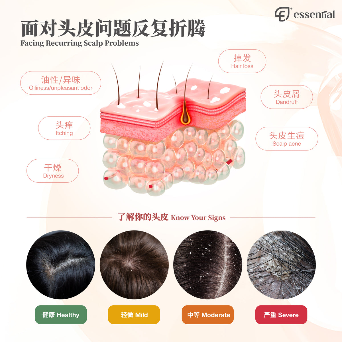 Essential Revitalising Scalp Shampoo 250ml | For Itching, Hair loss, Scalp Acne, Dandruff, Dryness