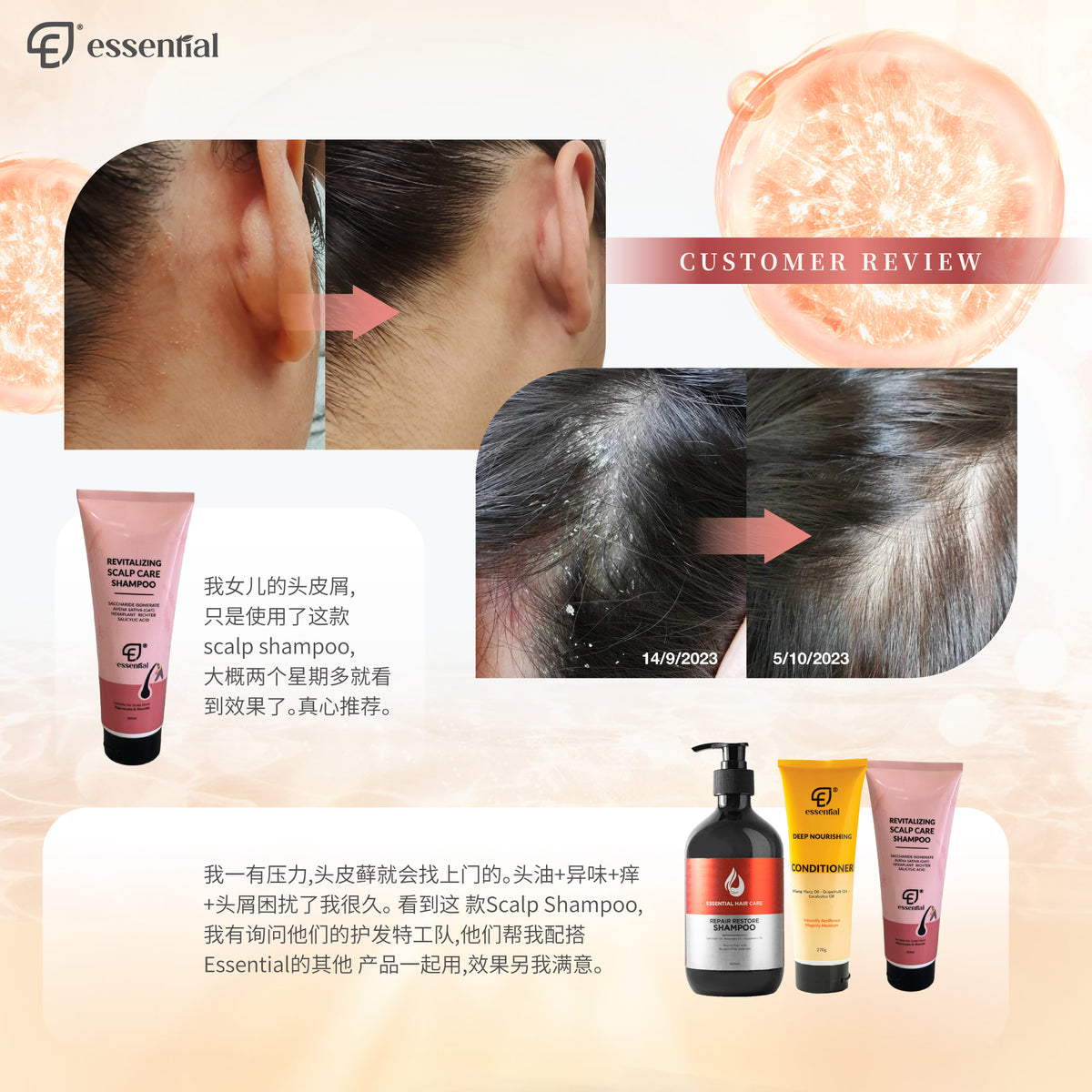 Essential Revitalising Scalp Shampoo 250ml | For Itching, Hair loss, Scalp Acne, Dandruff, Dryness